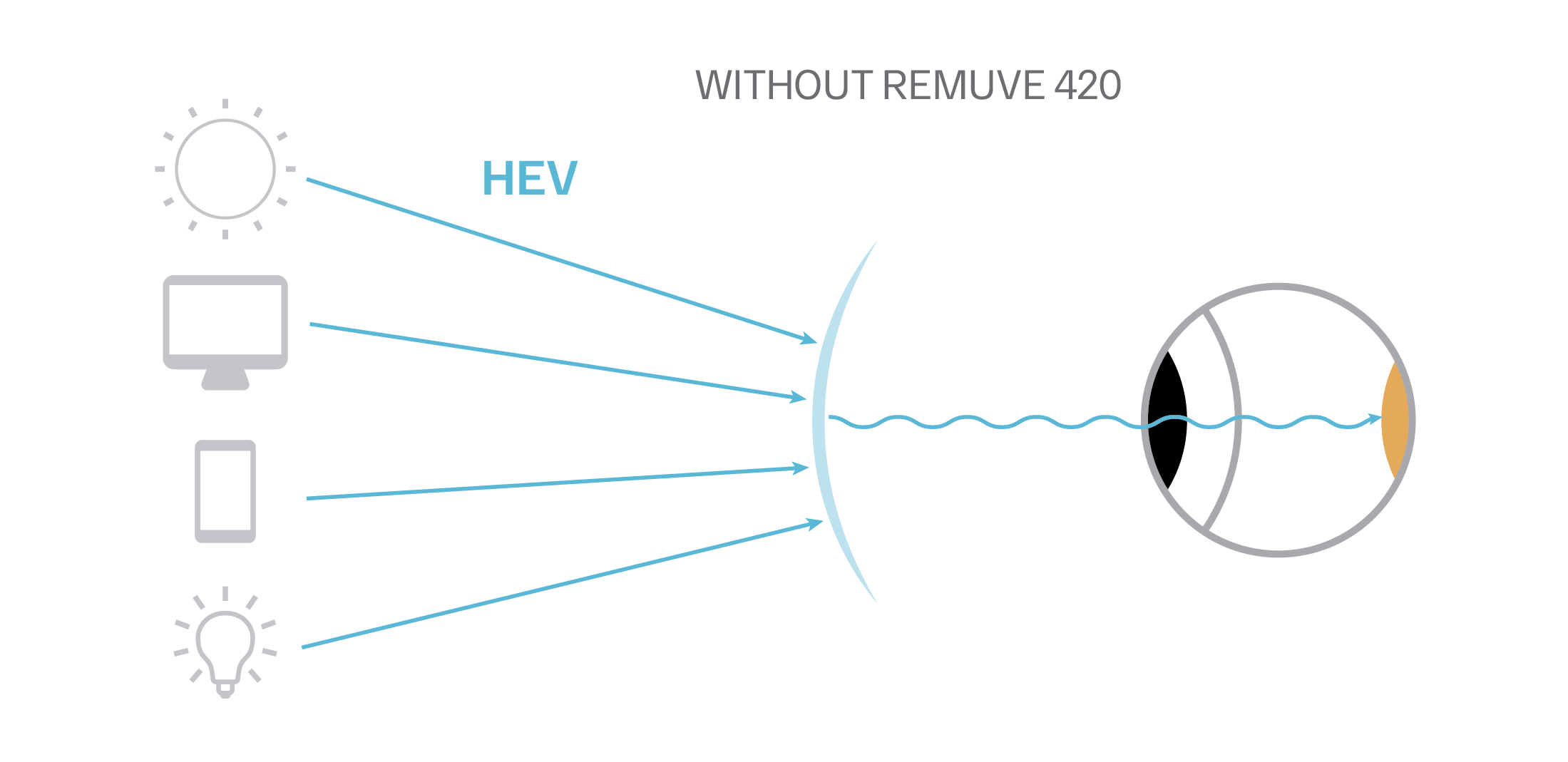 remuve